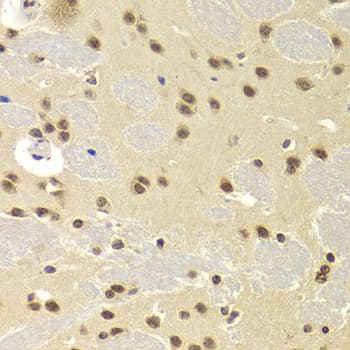 Polyclonal Rabbit anti-Human SNRPA / U1A Antibody (IHC, IF, WB)