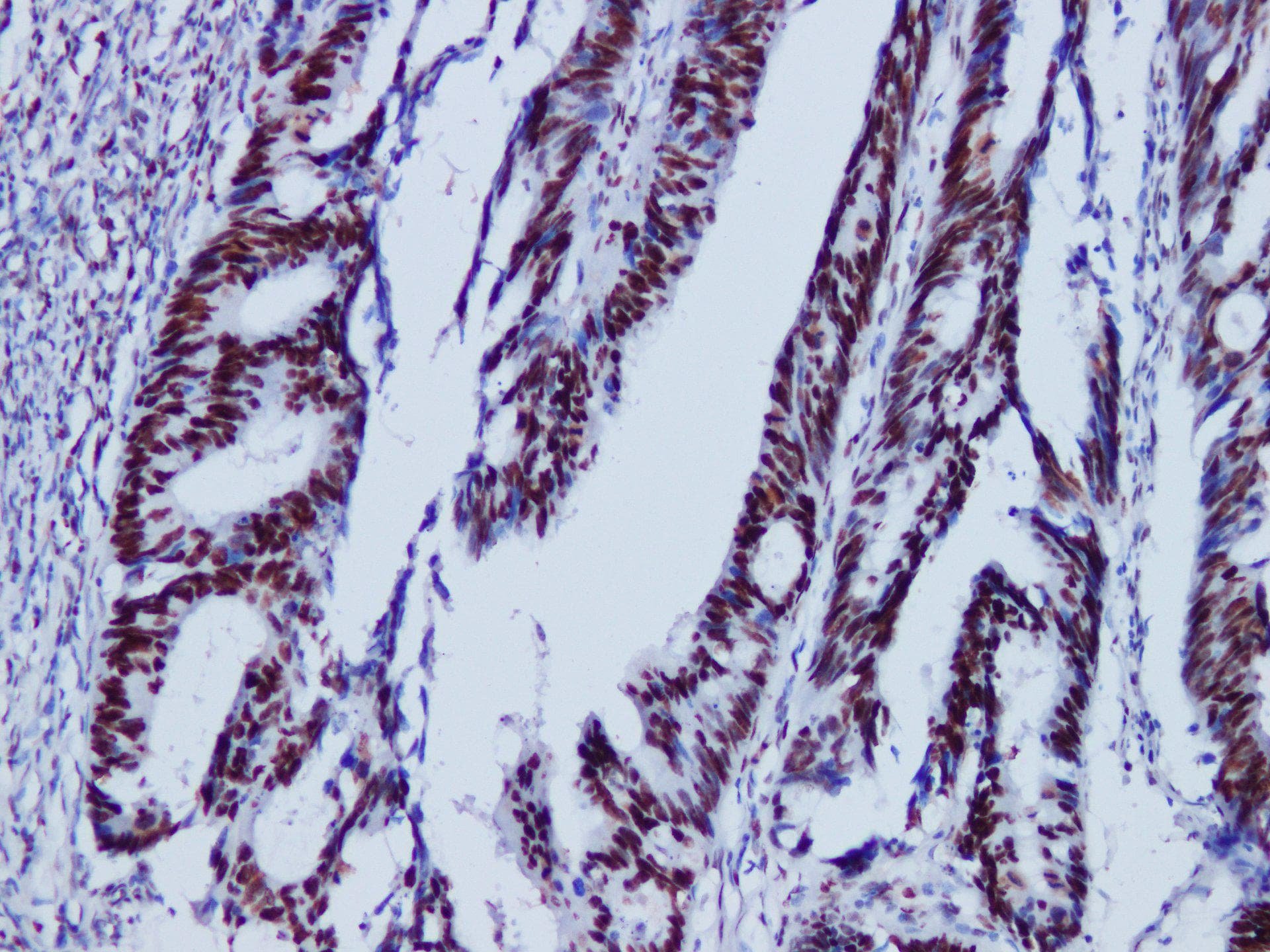 MSH2 Antibody