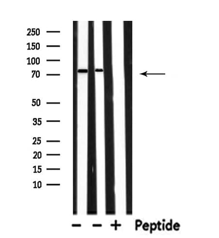 RAP1GAP Antibody