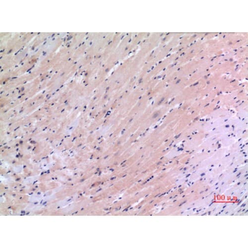 Polyclonal Rabbit anti-Human VEGFC Antibody (91-140 aa, Internal, IHC, WB)