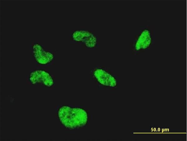 IHC-plus™ CGGBP1 Antibody (clone 1D11)