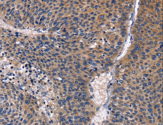 PRKCD / PKC-Delta Antibody