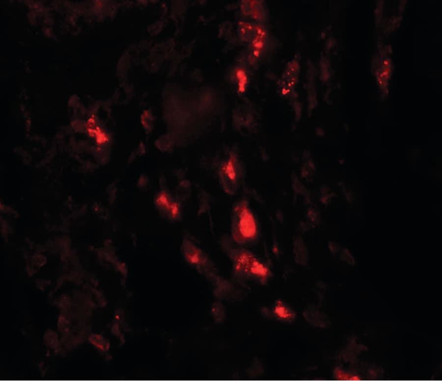 IHC-plus™ Polyclonal Rabbit anti-Human ARSB / Arylsulfatase B Antibody (IHC, IF, WB)