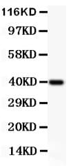 Polyclonal Rabbit anti-Human CHUK / IKKA / IKK Alpha Antibody (aa411-745, IHC, WB)