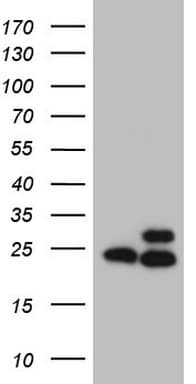 Monoclonal Mouse anti-Human RPL10 / Ribosomal Protein L10 Antibody (clone OTI9A8, Carrier-free, IHC, WB)