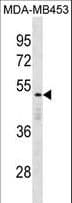 Polyclonal Rabbit anti-Human DEDD Antibody (aa165-191, WB)