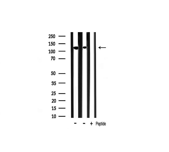 INPP5D / SHIP1 / SHIP Antibody