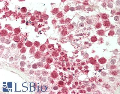 IHC-plus™ Capicua / CIC Antibody (aa1150-1200)