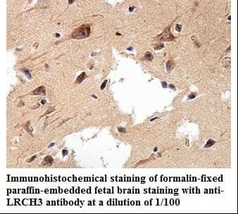LRCH3 Antibody (aa285-455)