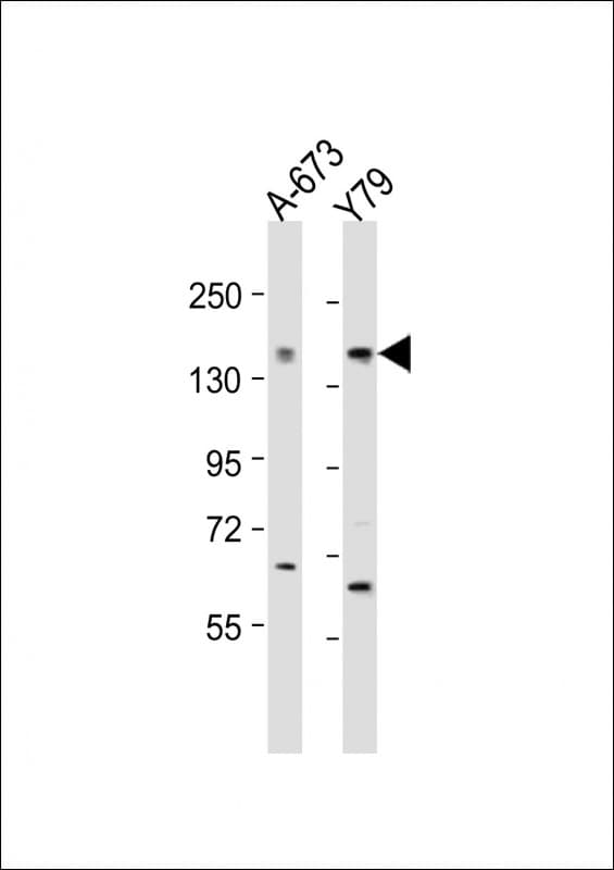 Polyclonal Rabbit anti-Human CACNA1F / Cav1.4 Antibody (aa743-776, WB)
