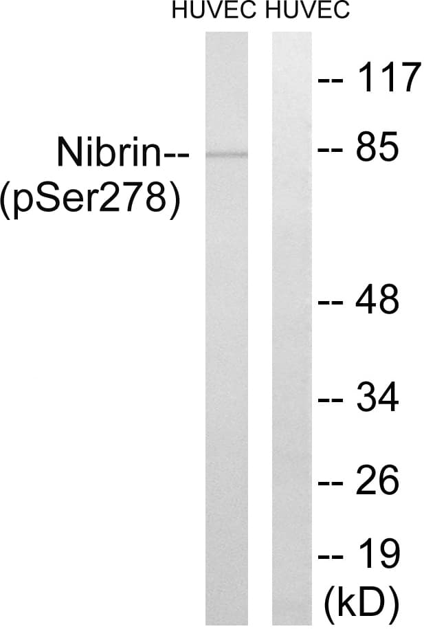 Polyclonal Rabbit anti-Human NBN / Nibrin Antibody (phospho-Ser278, IF, WB)
