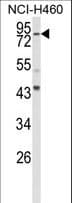 SPG20 / SPARTIN Antibody (aa18-45)