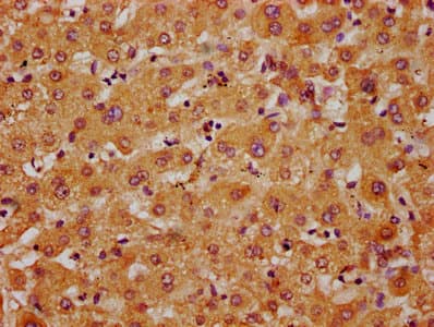 Polyclonal Rabbit anti-Human APMAP / C20orf3 Antibody (IHC, IF, WB)