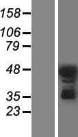 PRKCD / PKC-Delta Protein (Over-Expression Lysate Myc-DDK (Flag))