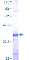 Human F2RL3 / PAR4 Protein (Recombinant GST, N-terminus)