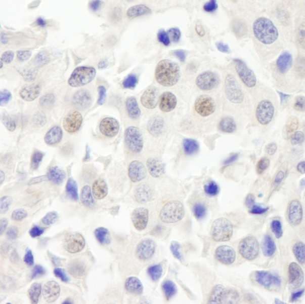 C17orf71 Antibody (aa250-300)