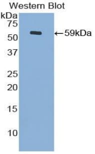 CDH4 / R Cadherin Antibody (aa667-916)