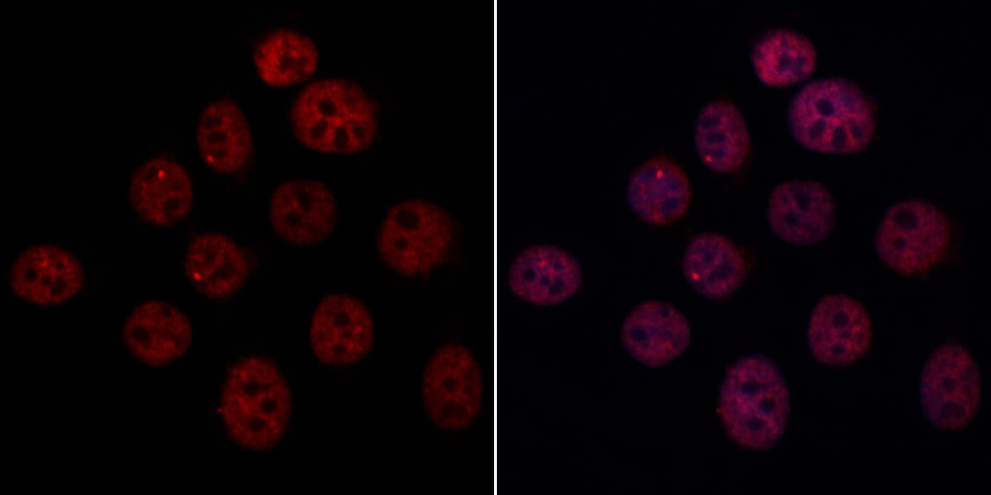 ARIH2 Antibody