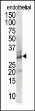RCAN1 / DSCR1 Antibody (aa75-104)