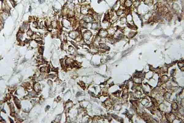 HLA-DOA Antibody (Val111)