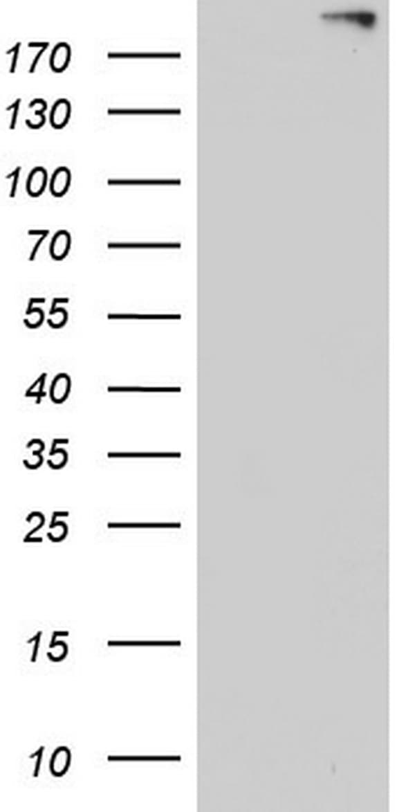 ANO1 / DOG1 / TMEM16A Antibody (aa1-333, clone OTI1E6)