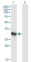 ING2 Antibody (clone 1D1)