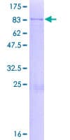 Human COPD / ARCN1 Protein (Recombinant GST)