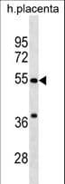 CHST2 Antibody (aa493-522)