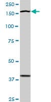 TEK / TIE2 Antibody (clone 3A5)