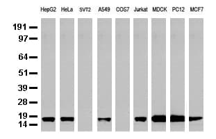 NME1 / NM23 Antibody (clone UMAB93, Carrier-free)