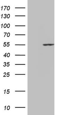Monoclonal Mouse anti-Human PPP1R36 / C14orf50 Antibody (clone OTI5C10, WB)