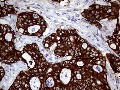 AGR2 Antibody (aa21-175, clone OTI2D11)