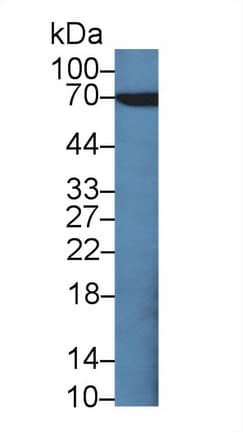 CEA / Carcinoembryonic Antigen Antibody (aa448-572, Cy3)