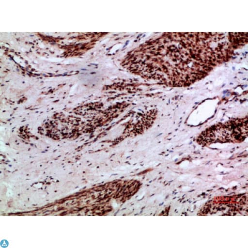 Polyclonal Rabbit anti-Human TMPO / TP / Thymopoietin Antibody (IF, WB)