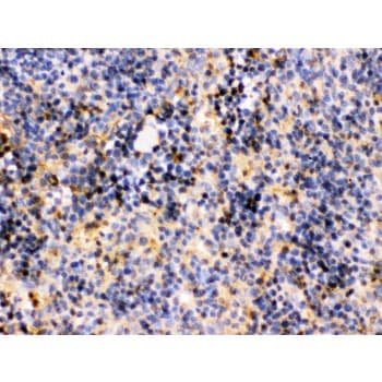 TRIB2 Antibody (aa175-211)
