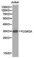 IHC-plus™ CD32A Antibody