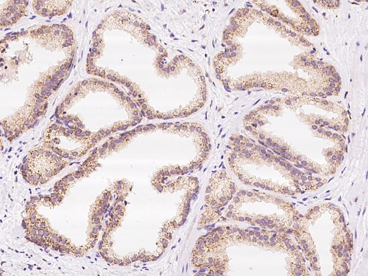 Polyclonal Rabbit anti-Human TNFRSF19 / TROY Antibody (Preservative Free, IHC)