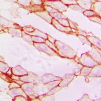 PXN / Paxillin Antibody (Internal)