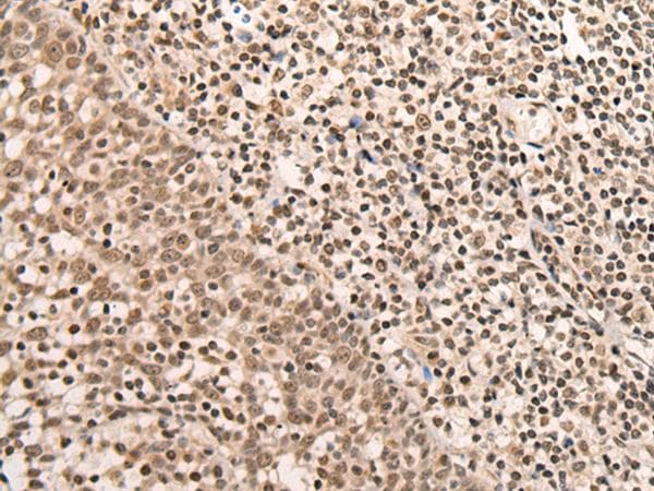 ARID1B / BAF250B Antibody