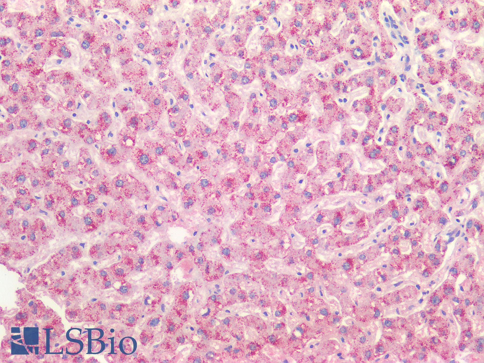 IHC-plus™ HAO1 Antibody (clone UMAB117)