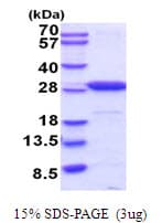 Mouse UCHL1 / PGP9.5 Protein (Recombinant His)