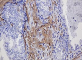 FNDC4 Antibody (clone OTI1B7)