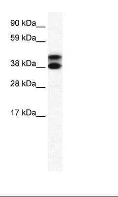 TRIM13 Antibody (aa165-214)