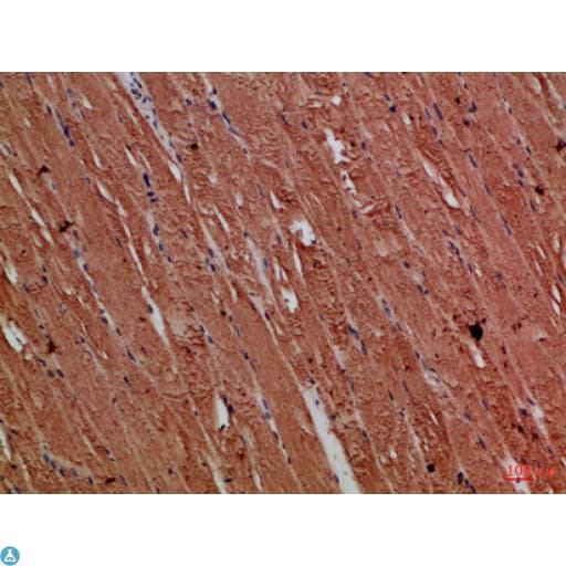 TNRC5 / CNPY3 Antibody