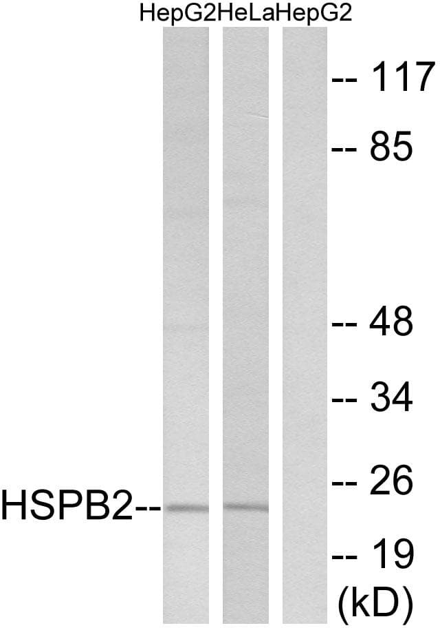 HSPB2 / HSP27 Antibody