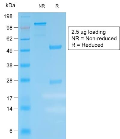 Kappa Light Chain Antibody (clone IGKC/1999R, Azide-free, Carrier-free)
