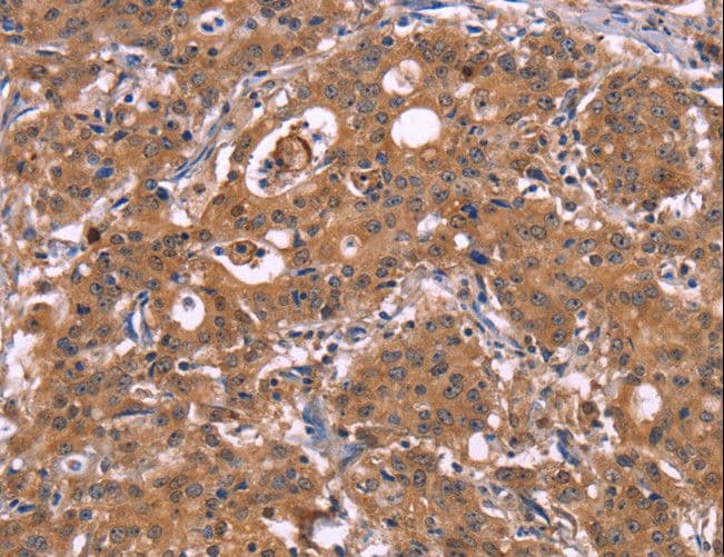 HMGCS1 / HMG-CoA Synthase 1 Antibody