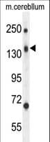 Polyclonal Rabbit anti-Human CD109 Antibody (aa82-109, WB)