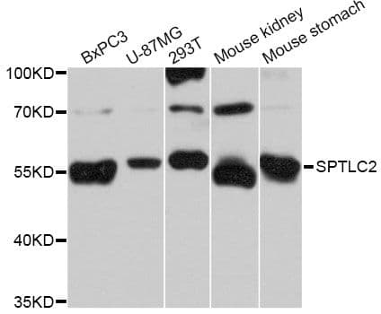 Polyclonal Rabbit anti-Human SPTLC2 / LCB2 Antibody (WB)
