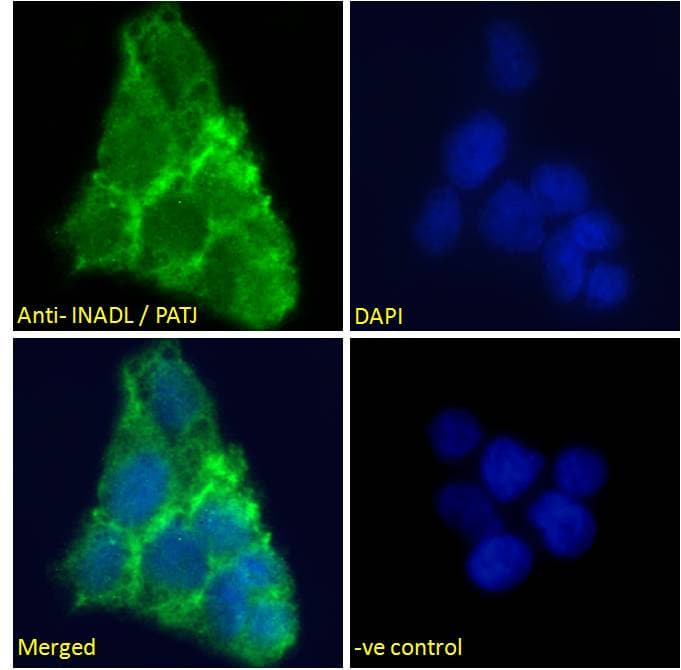 IHC-plus™ INADL / PATJ Antibody (aa2-14)